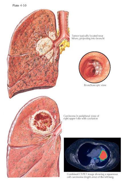 Pin on Respiratory System