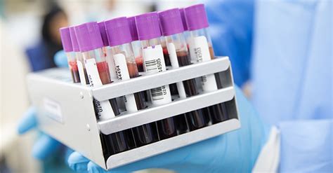 Checking Blood for Coronavirus Antibodies—3 Questions Answered About Serological Tests and ...