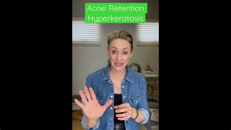 Acne: Retention Hyperkeratosis #acne #retinolskincare #retinoids101 #retinacream #tretinoin ...