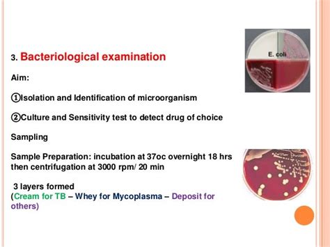 MASTITIS DIAGNOSIS by ADIL RASOOL PARAY