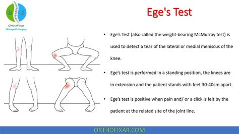 Ege's Test | Weight-Bearing McMurray Test | OrthoFixar 2025