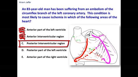 Distribution of the circumflex branch of left coronary artery - YouTube