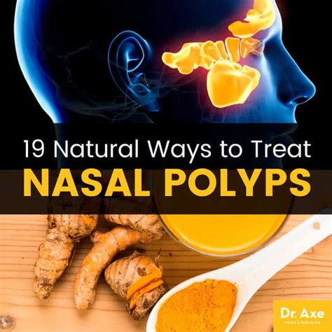 Nasal Polyps: 19 Natural Treatments + Lifestyle Changes - Dr. Axe