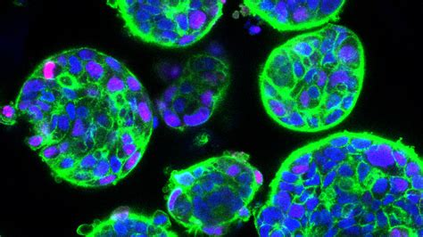 Recreating Liver Tumours as Organoids for Faster, More Accurate Drug Screening - NUS Yong Loo ...