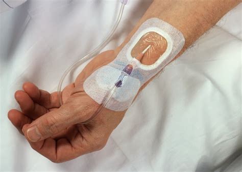 vox médica : Arterial Catheters and Risk of Bloodstream Infection