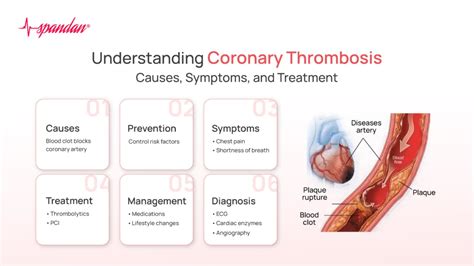 Decoding Coronary Thrombosis: Causes, Symptoms, & Treatment