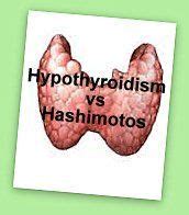 Hypothyroidism vs. Hashimoto's: what's different and what's similar | Hypothyroidism, Hashimoto ...