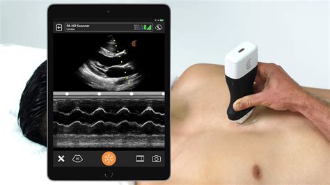 High-Definition Handheld Ultrasound Scanner Available Now for Rapid Bedside Cardiac Exams ...