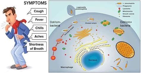 Virulence factors, Pathogenesis and Clinical manifestations of Legionella pneumophila