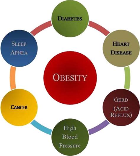 Obesity, causes, complications and prevention - Homeopathic Specialist ...