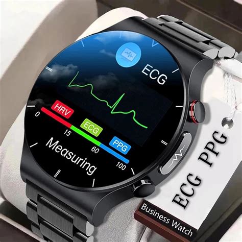 Xiaomi Smartwatch Ecg | lupon.gov.ph