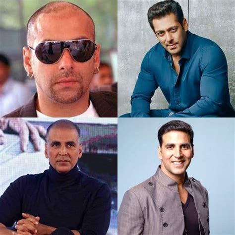 SHOCKING! 5 Bollywood actors who underwent for hair transplant