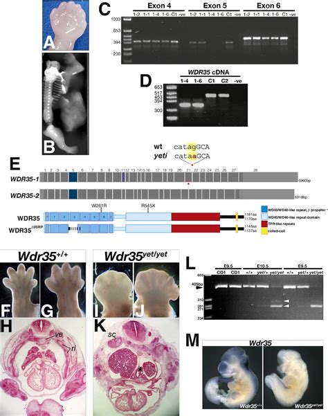 Figure 1 from Human and mouse mutations in WDR35 cause short-rib ...