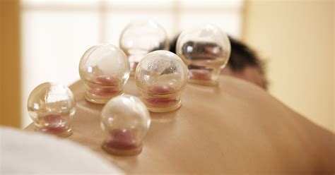 Cupping Therapy for Pain | Ananta Wellness