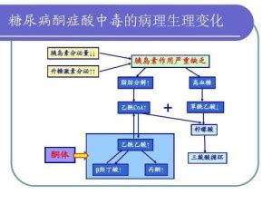 糖尿病酮症酸中毒 - 搜狗百科