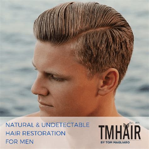 Explore Effective Treatment for Receding Hairline | TM Hair