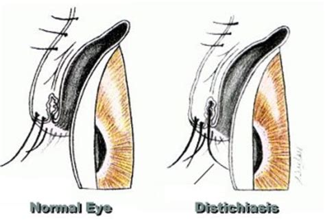 Distichiasis in Dogs – A Hairy Eyelid Problem!