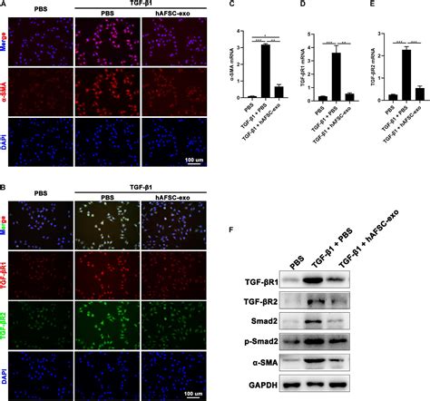 Frontiers | Human Amniotic Fluid Stem Cell-Derived Exosomes as a Novel Cell-Free Therapy for ...