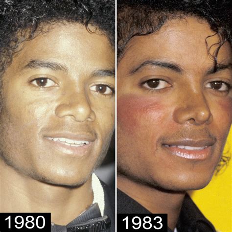 Michael Jackson's Plastic Surgery — See His Transformation