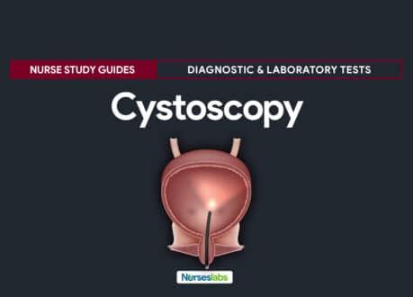 Cystoscopy - Nursing Responsibilities - Nurseslabs