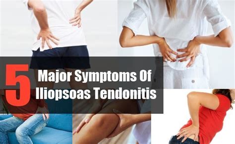 Effective Hip Flexor Stretch: 5 Major Symptoms Of Iliopsoas Tendonitis | Iliopsoas tendonitis ...