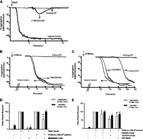 PAR-1 and thromboxane receptors do not mediate TCIPA or TCIPS. (A-C ...