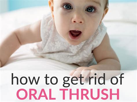 How to Get Rid of Oral Baby Thrush - 7 Home Remedies that Work Quickly ...