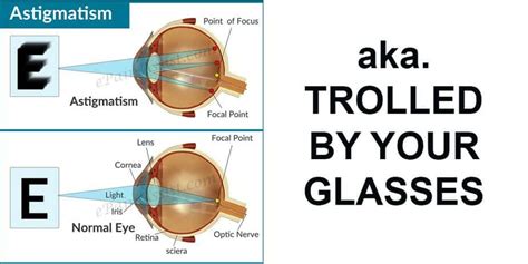 Jaanus' Optometrist: "Astigmatism Correction Is For Rare, Serious Cases" - Endmyopia® - The ...