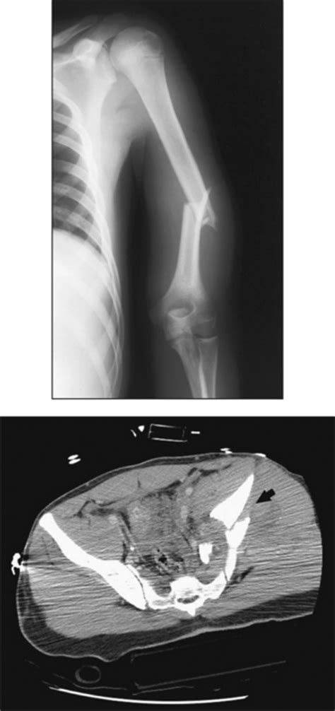 TRAUMA RADIOGRAPHY | Radiology Key