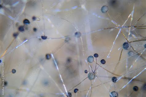 Backgrounds Colony Characteristics of Rhizopus (bread mold) is a genus ...