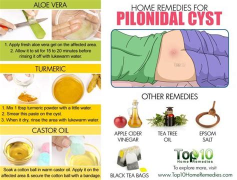 Home Remedies for Pilonidal Cysts (Large Pimple at Bottom of Tailbone) | Top 10 Home Remedies