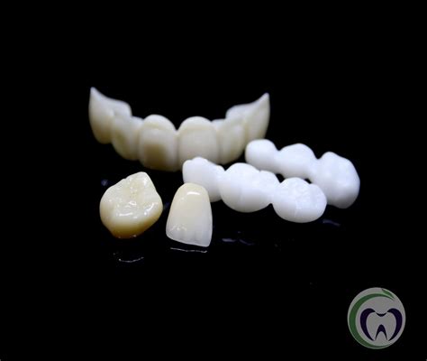 Zirconia Crowns Before And After | Dr. Ari Greenspan Dentist