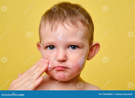 Mother Smears Allergy Cream on Face of Toddler Baby, Studio Yellow Ba ...