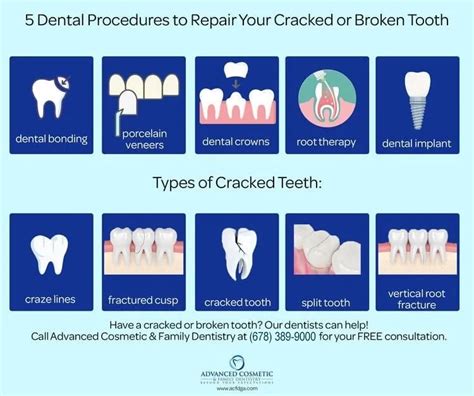 5 Dental Procedures to Repair Your Cracked or Broken Tooth