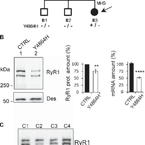 Expression of RyR1 in heterozygous RyR1 +/– mouse muscles. (A ...