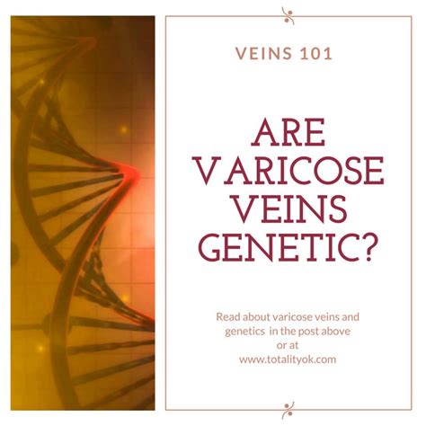 Veins 101: Are Varicose Veins Genetic? | Totality