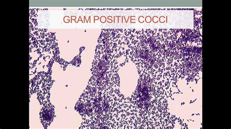 Gram Positive Cocci Examples : Hybridization examples of gram-positive ...