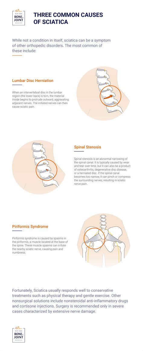 What Causes Sciatic Nerve Pain? - New York Bone & Joint Specialists