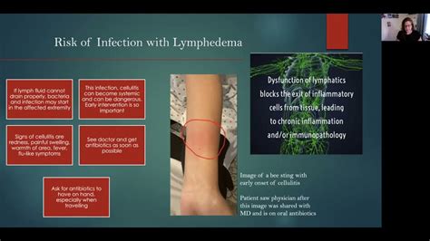 Bee Sting Infection Cellulitis | ppgbbe.intranet.biologia.ufrj.br