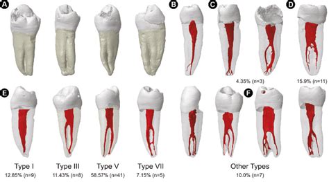 Mandibular Premolar Forceps