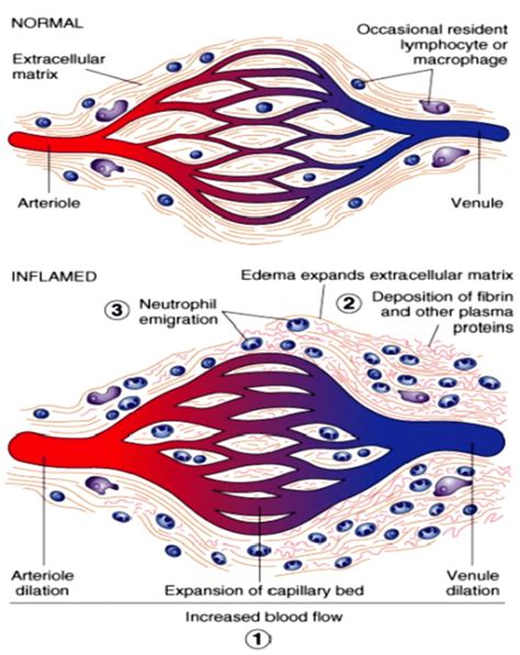 Events and phases of inflammation: During injury causes local ...