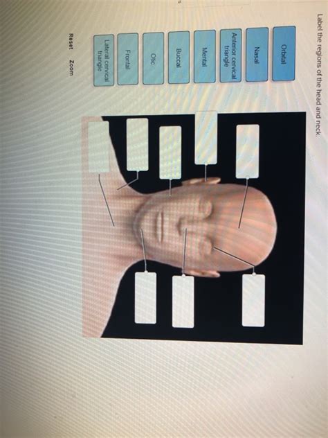 Solved Label the regions of the head and neck. Orbital Nasal | Chegg.com