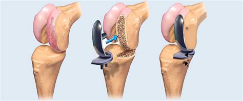 Pin on Best orthopaedic surgeon in indore