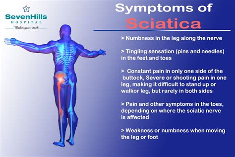 What Is Sciatica What Are The Symptoms Of Sciatica | Images and Photos finder