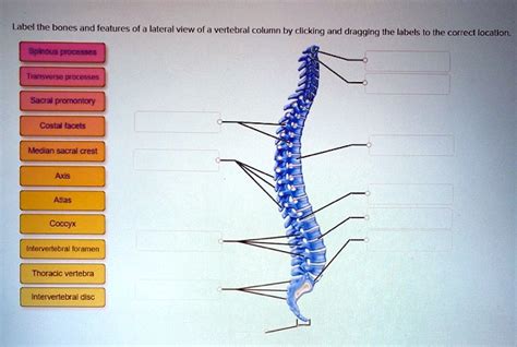 SOLVED: Label the bones and features of a lateral view of a vertebral column by clicking and ...