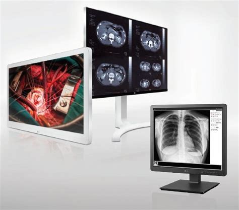 Medical Display | Medical Standard