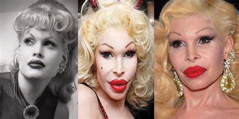 Amanda Lepore Plastic Surgery Before and After Pictures 2024