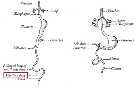 Small Intestine Diverticula - The Operative Review Of Surgery