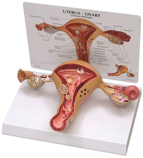 GPI Anatomicals - Uterus and Ovary Model with Pathologies