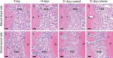 Histological changes in the periodontal tissues during tooth movement... | Download Scientific ...